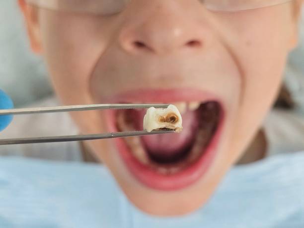 Best Cosmetic Emergency Dentistry in Cumberland Head, NY